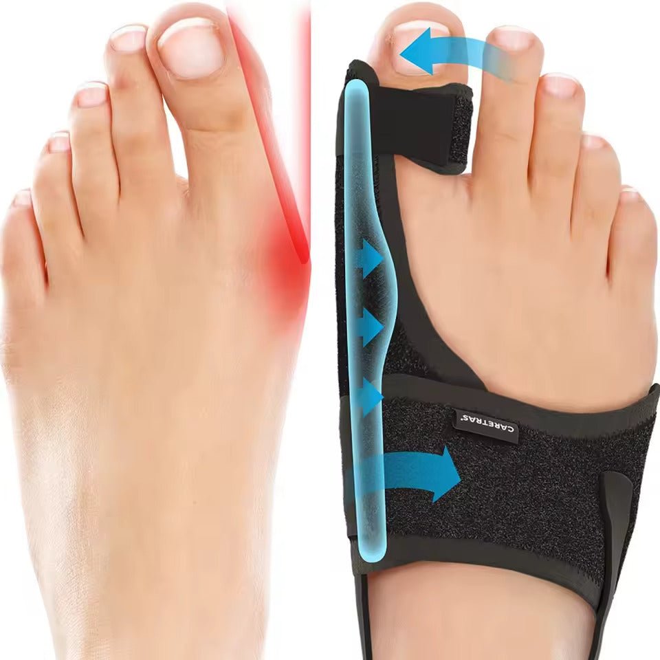 Adjustable Hallux Valgus Night Splint