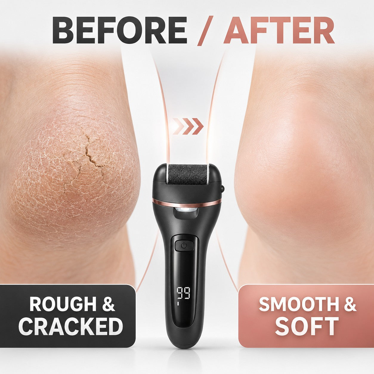 Before and after - rough cracked heels turned smooth and soft